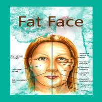 كپسول چاق كننده صورت فت فيس fat face